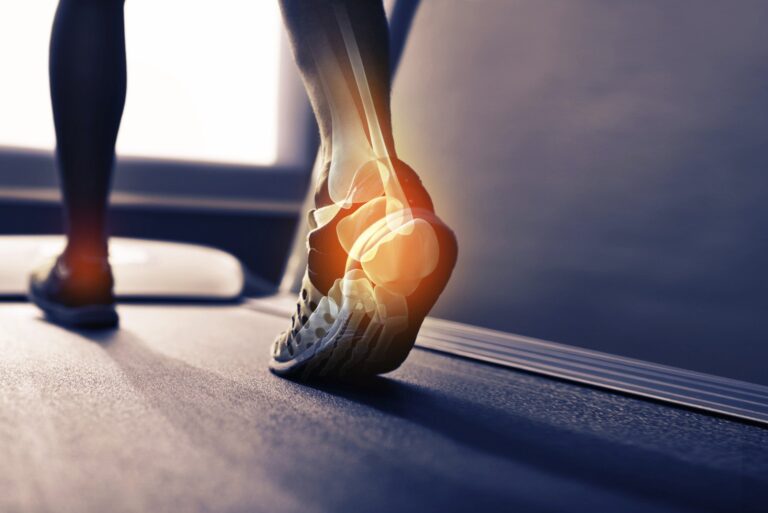 What should I do if I think I have plantar fasciitis