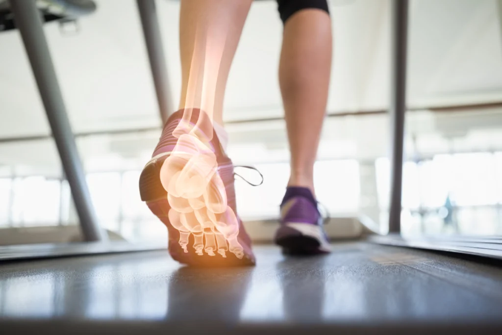 Gait Analysis