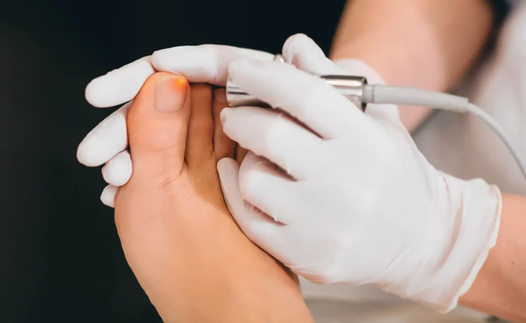 K-Laser Therapy Section 2