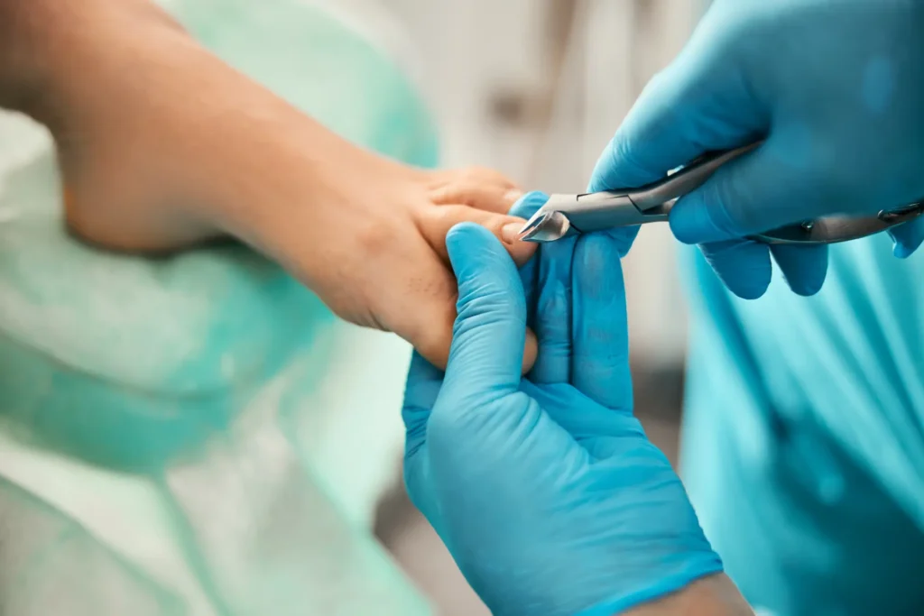 Nail Surgery 3