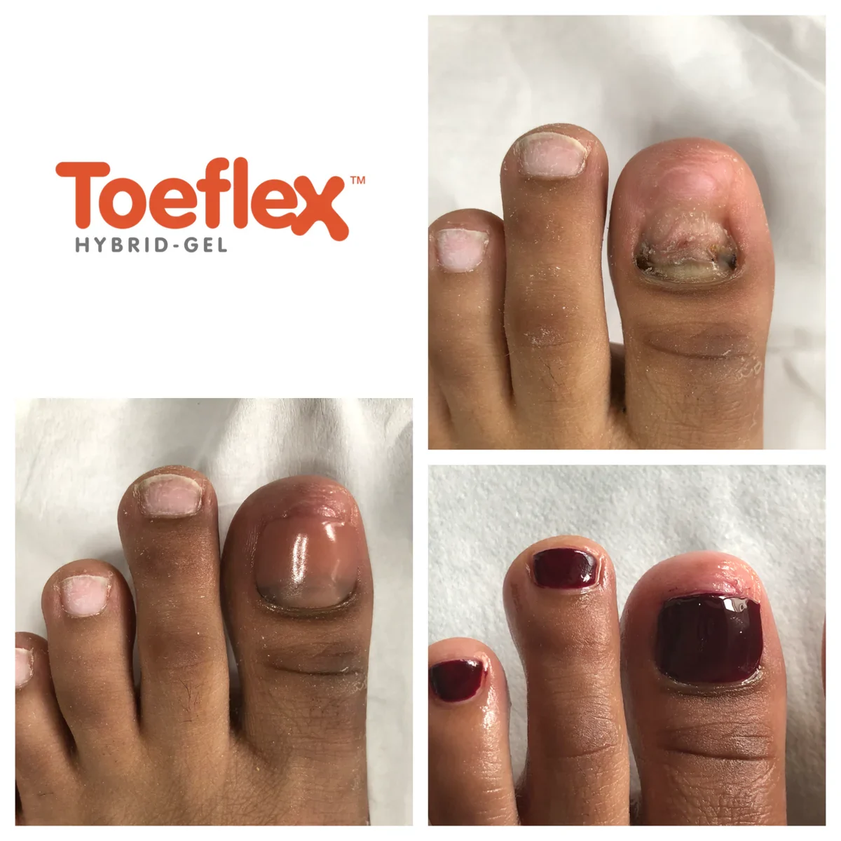 Toe_flex_image_1_1200x1200